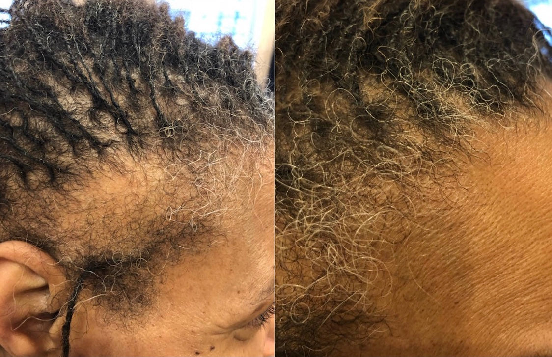 Start growing for Christmas